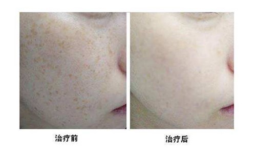 河北腿部吸脂整形，哪家醫(yī)院技術(shù)專業(yè)值得信賴？2023年十所靠譜腿部吸脂整形醫(yī)院推薦！