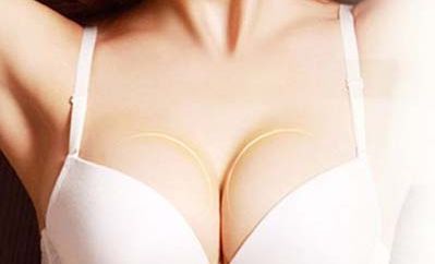 標(biāo)題：換個角度，欣然接納整容手術(shù)的魅力！