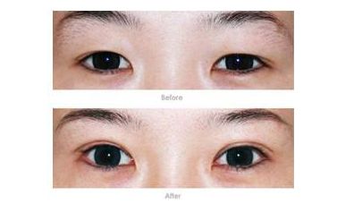 上海翼鼻塑形醫(yī)生李青峰、戴傳昌等8位專(zhuān)家堪稱(chēng)行業(yè)瑰寶