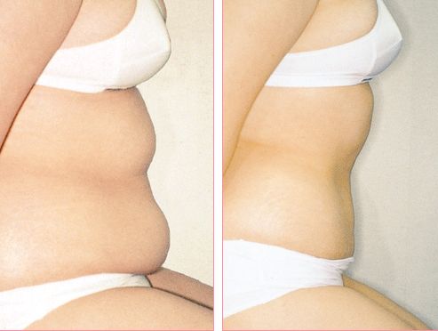 南京哪家醫(yī)院的緊膚除皺效果最好？