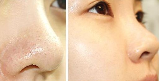 廣州假體隆胸哪家品質(zhì)好？如何選擇最佳廣州假體隆胸醫(yī)院？