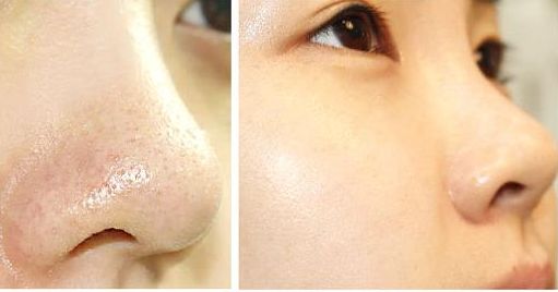 合肥市有哪些值得推薦的美容醫(yī)院？