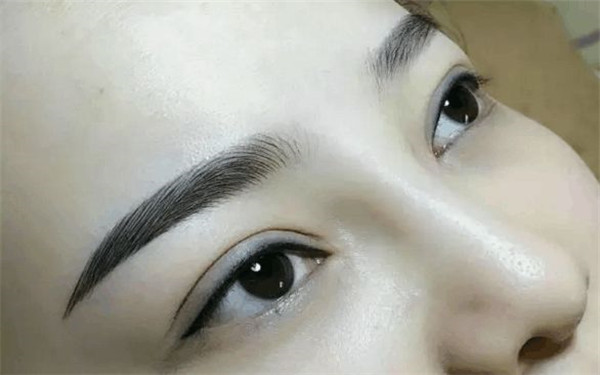 生物焊接雙眼皮手術(shù)：價(jià)格如何？