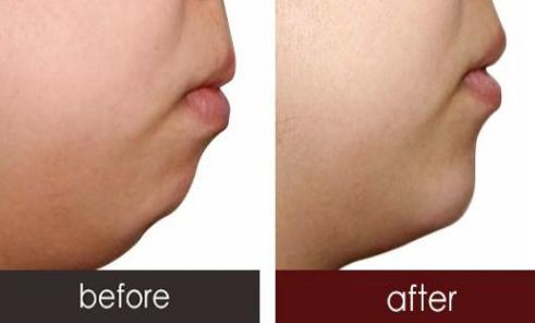 沈陽鼻綜合哪家醫(yī)院好？探尋專家推薦出的頂尖醫(yī)療機構(gòu)