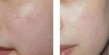 江疏影的外貌變化引發(fā)網(wǎng)友猜測：她是否進行了整容？