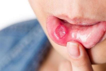 大連哪家醫(yī)院的雙眼皮埋線效果好？