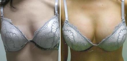 威海市婦幼保健院整形科值得信賴嗎？威海市立第二醫(yī)院整形效果如何？