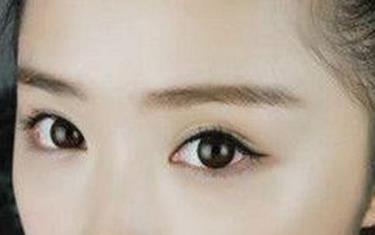 如何進行面部自體脂肪填充？填充面部的項目是否有優(yōu)點和缺點？