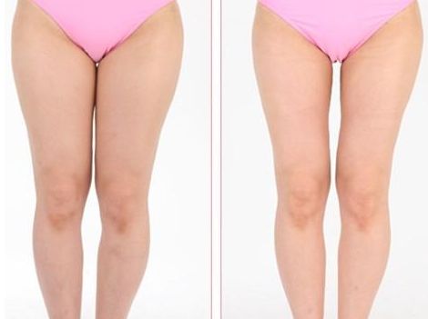 上海激光美容哪家醫(yī)院好？探尋最受用戶喜愛的激光美容機(jī)構(gòu)