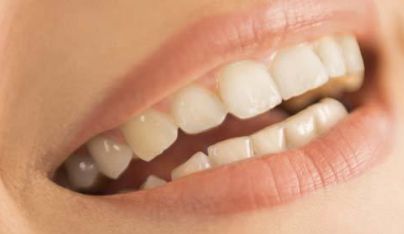 深圳面部填充哪家醫(yī)院好？選擇專業(yè)整形醫(yī)院讓你更美麗！