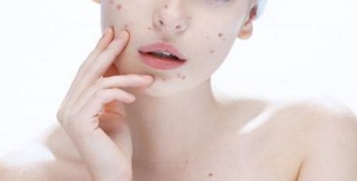 重點推薦：大連眼部整形醫(yī)生，獨家專長雙眼皮手術(shù)及修復(fù)，受歡迎程度和價格公允！