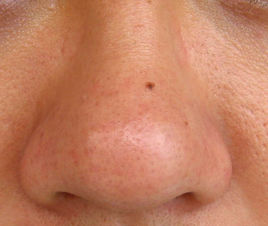 2023長沙飛頓激光脫毛醫(yī)療美容醫(yī)院排行榜前10家，絕對讓你愛美無懈可擊！