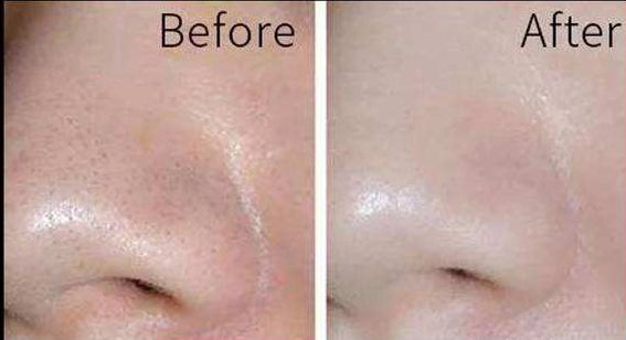 杭州整容醫(yī)院盤點(diǎn)，醫(yī)美大名鼎鼎，值得參考！