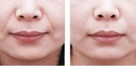 江蘇哪家醫(yī)院是正規(guī)的美容醫(yī)院？靠譜的美容機(jī)構(gòu)排行榜