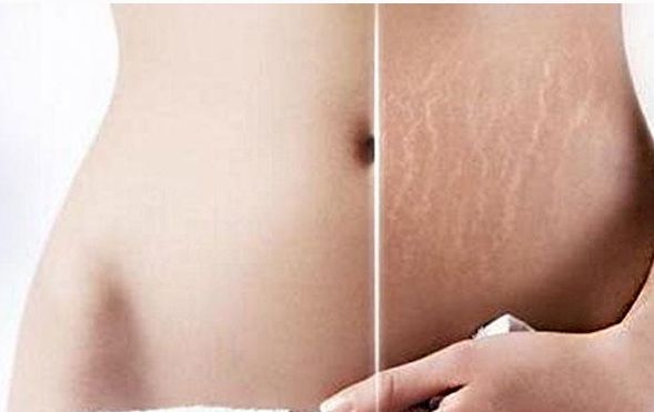 綿陽哪家醫(yī)院做眼袋手術(shù)好？