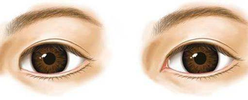 大連哪家醫(yī)院做疤痕手術(shù)效果最好？