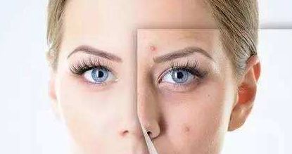 【揭秘】廣州五家熱門胸部整形醫(yī)院，口碑榜前五強(qiáng)_附價(jià)目表全解析！