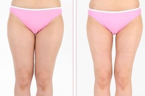 蘇州眼部微整哪家醫(yī)院好？真實(shí)案例揭秘！