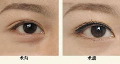 杭州最受用戶推薦的靠譜吸脂醫(yī)院是哪家？