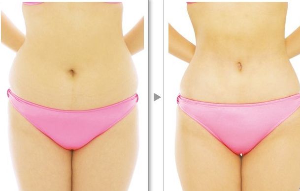 西寧好的隆胸醫(yī)院是哪家好？專家推薦以及詳細(xì)解析