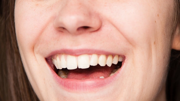 蘭州雙眼皮整形醫(yī)院匯總單前十年中，亞韓與華美哪個(gè)效果更佳？豪華VS貼心服務(wù)，你會(huì)選擇哪一家？