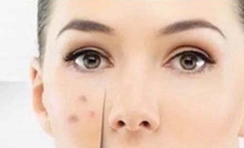 重慶腰部吸脂完美技術(shù)比拼，恭城醫(yī)院對(duì)比整形機(jī)構(gòu)排行！