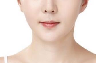 用激光磨皮是否能去除痘印？真實(shí)體驗(yàn)告訴你答案