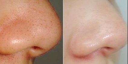 杭州整形美容哪家好？2023杭州整形美容排行榜揭曉