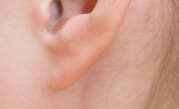 激光洗眉導致疤痕，如何有效去除疤痕？