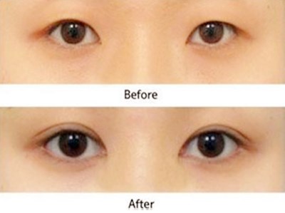 2023年武漢面部微創(chuàng)除皺手術(shù)前10家醫(yī)院排行榜，哪家信譽口碑更好？網(wǎng)友評選推薦！