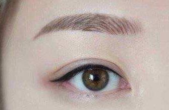 注射除皺瘦身術(shù)適合哪些人？有哪些適應(yīng)癥？