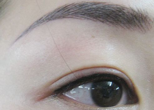 許昌整形界的新熱門：雙眼皮糾紛解決方案揭秘