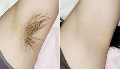 保定市美容醫(yī)院哪家好？綜合評比看這里！