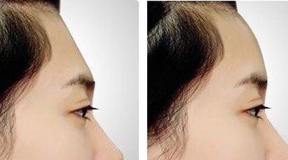 浙江臺州整容醫(yī)院哪家好？如何選擇最適合自己的整容醫(yī)院？