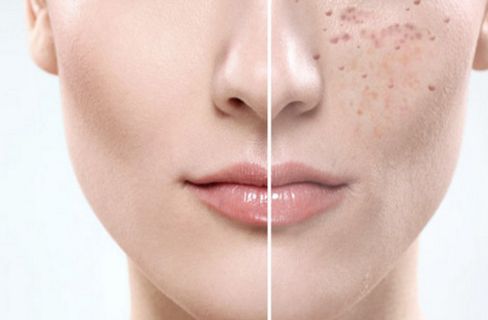 昆明最靠譜的雙眼皮醫(yī)院排行榜