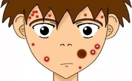 黑臉娃娃能否去除黑色素？有沒有靠譜的方法？