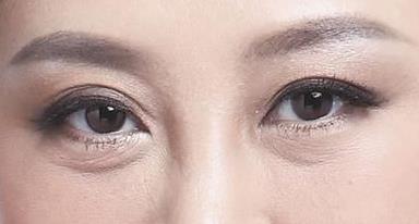 烤瓷牙是什么？它的優(yōu)點在哪里？價格大約是多少？