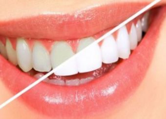 北京哪家醫(yī)院豐面頰好？專家推薦的北京豐面頰頂級(jí)醫(yī)院排行榜！