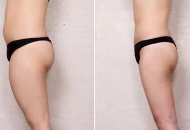 上海哪家醫(yī)院的皮秒祛斑效果好