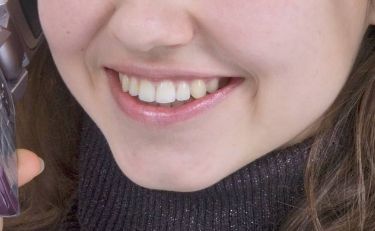 ?？谌ヌヰ肽募裔t(yī)院靠譜？【2023最新】