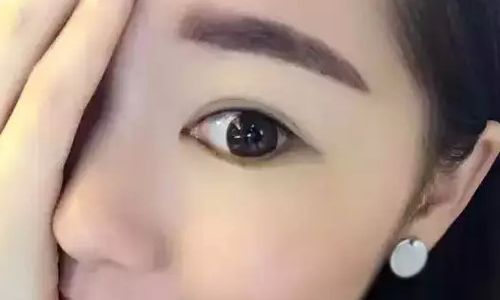 西寧雙眼皮修復好的醫(yī)院有哪些？