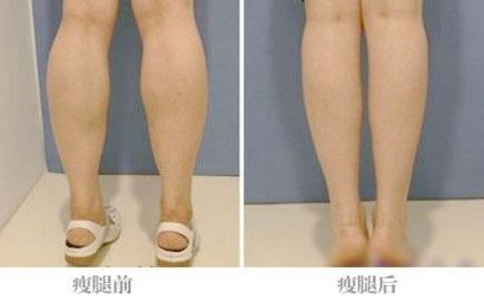 面部拉皮提升專家實力搶眼，哪位醫(yī)生效果比較好？