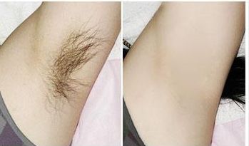 武漢市哪家醫(yī)療美容科好？排名和口碑都很不錯的醫(yī)院有哪些？