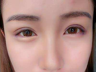 滄州奧拉克醫(yī)療美容醫(yī)院是真的靠譜嗎？醫(yī)生的技術(shù)水平如何？