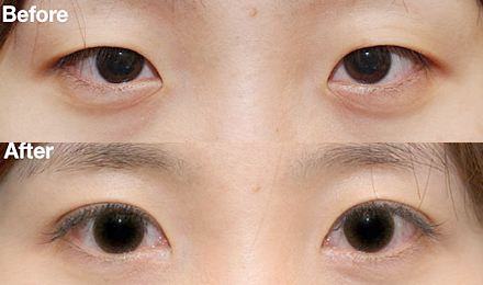 2023年，武漢哪家隆鼻醫(yī)院效果比較好？排名前10家一文推薦