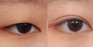 昆明哪家正規(guī)美容醫(yī)院靠譜？-權(quán)威專業(yè)排名引領(lǐng)的推薦！