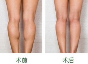 杭州祛眼袋哪家醫(yī)院做的好？