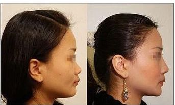 2023年溫州民營醫(yī)美機(jī)構(gòu)：口碑優(yōu)異，醫(yī)療技術(shù)各有特長！