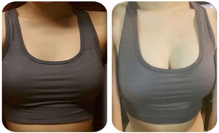 長(zhǎng)春哪家醫(yī)院的光子嫩膚效果好？2023長(zhǎng)春美白祛斑醫(yī)療整形醫(yī)院前10強(qiáng)技術(shù)實(shí)力PK！