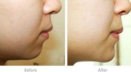 梅州美容整形機構(gòu)盛名傲鎮(zhèn)！2023醫(yī)美榜單大揭曉！